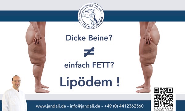 Lipödem00 0