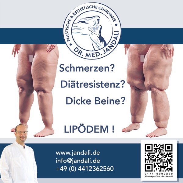 2lipödem neu