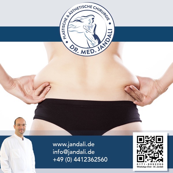 Liposuktion